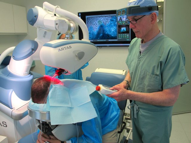 artas robotic hair transplant